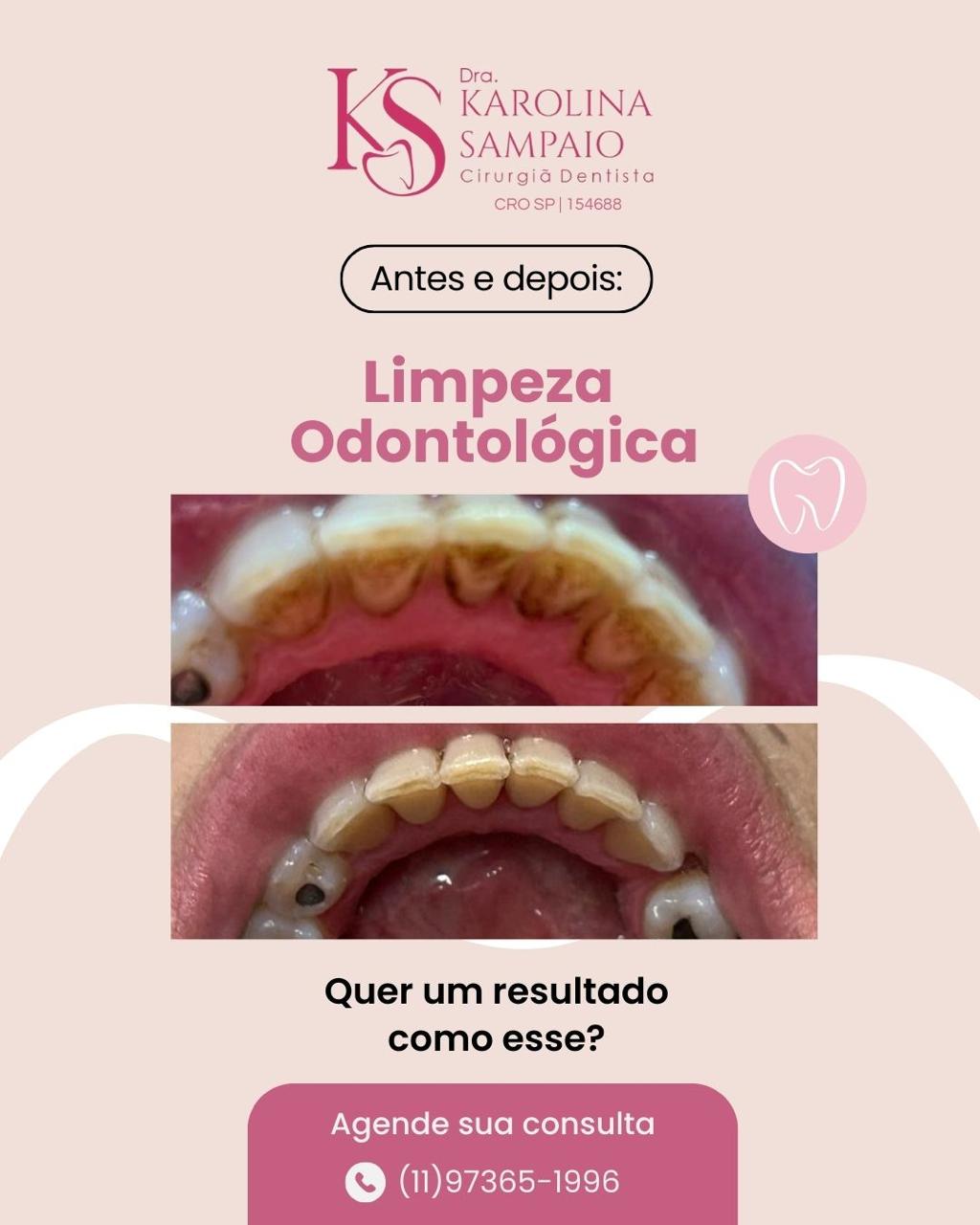 Resultado 3